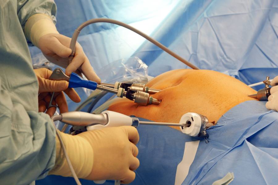 Bariatric Surgeon in New Delhi – Weight Loss Treatment by Dr. Jayadatt Pawar