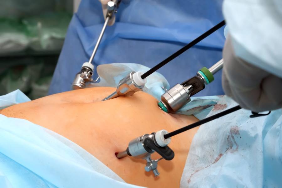 Best Laparoscopic Surgeon in New Delhi | Dr. Jayadatt Pawar performing Laparoscopic Surgery in New Delhi
