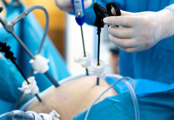 When You Need to Visit a Bariatric Surgeon_