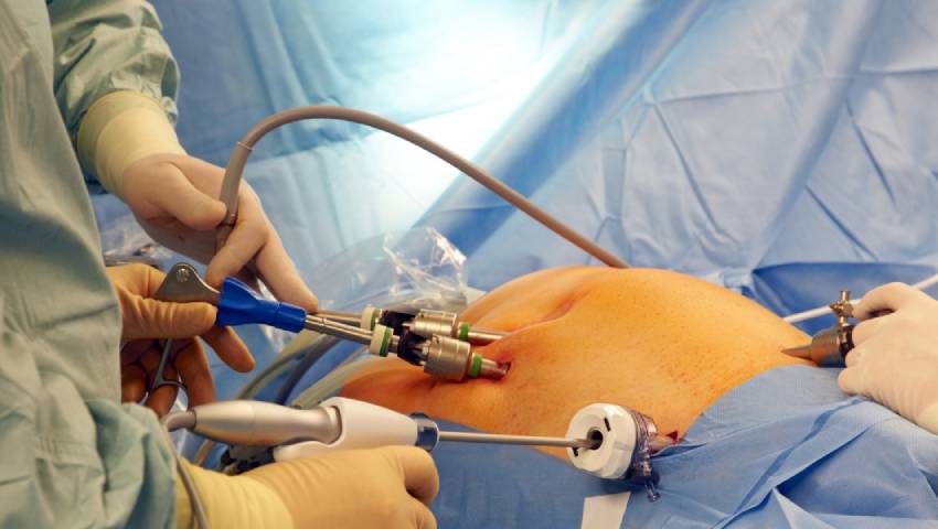 Best Laparoscopic Surgeon in New Delhi | Dr. Jayadatt Pawar performing Laparoscopic Surgery in New Delhi