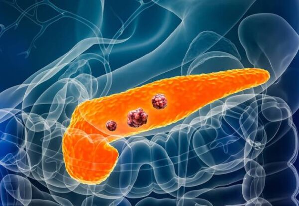 Pancreatic Cancer Awareness Month – Early Detection Guidance by Dr. Jayadatt Pawar