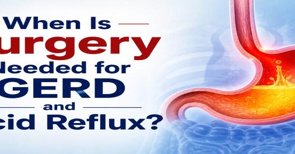 When Is Surgery Needed for GERD and Acid Reflux? Expert laparoscopic and robotic GERD treatment by Dr. Jayadatt Pawar in New Delhi.